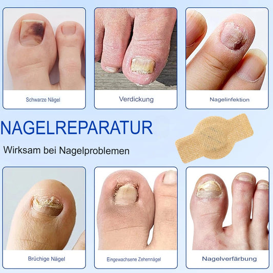 Nagelreparatur Pflaster Grau
